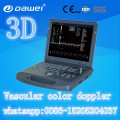 DW-C60 ultrasound echo laptop 3D machine